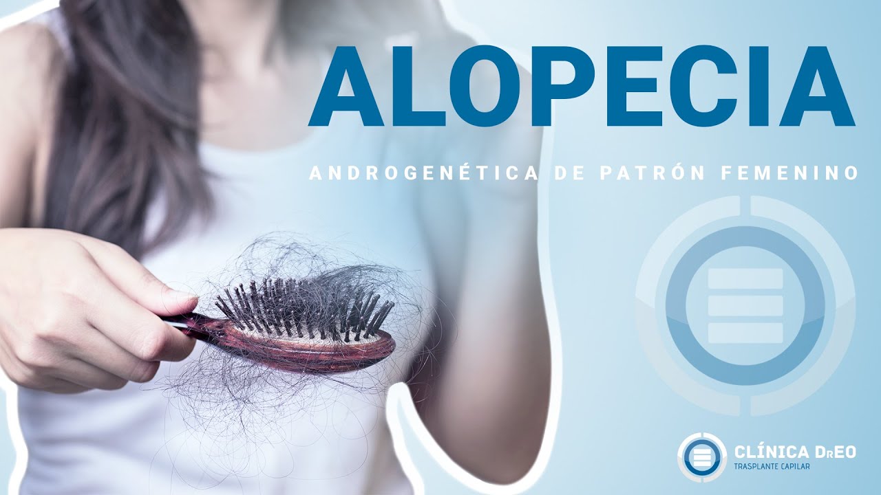 Alopecia o Calvicie en Mujeres. Todo lo que quieres saber y no te atreves a preguntar