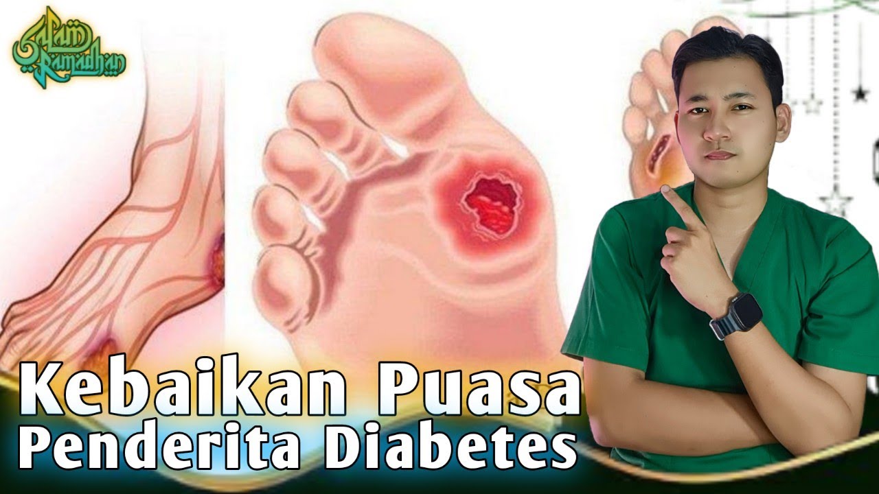 Kebaikan Puasa Bagi Diabates yang Menjalaninya || dr. Andi
