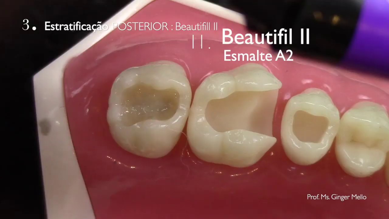 Beautifill