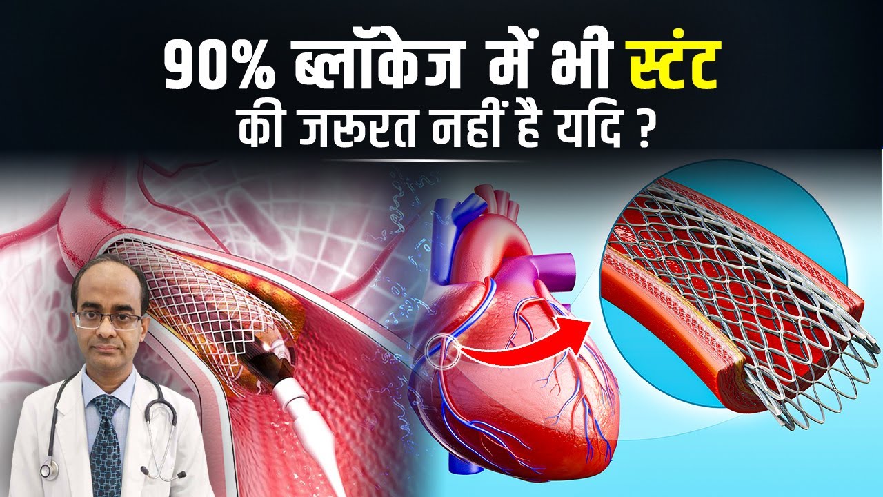 90% ब्लॉकेज में भी स्टंट की जरूरत नहीं है यदि ? #drrajneeshkumarpatel #heartblockage