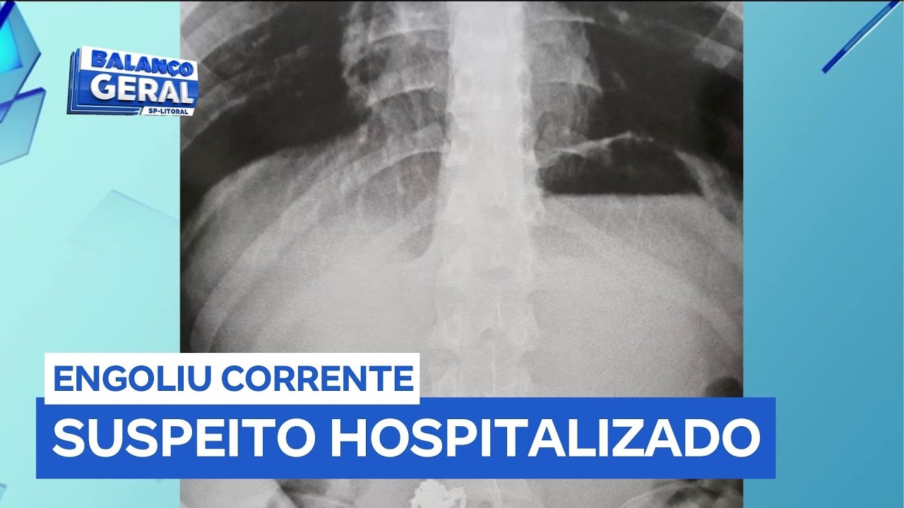 Homem rouba corrente de ouro e engole joia para tentar escapar da polícia