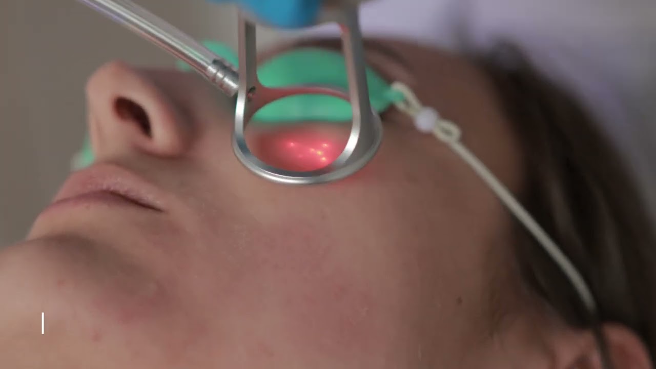 Perfectus™ - Jedyny tak wyposażony laser frakcyjny CO2. Skuteczna rewitalizacja i odmłodzenie skóry