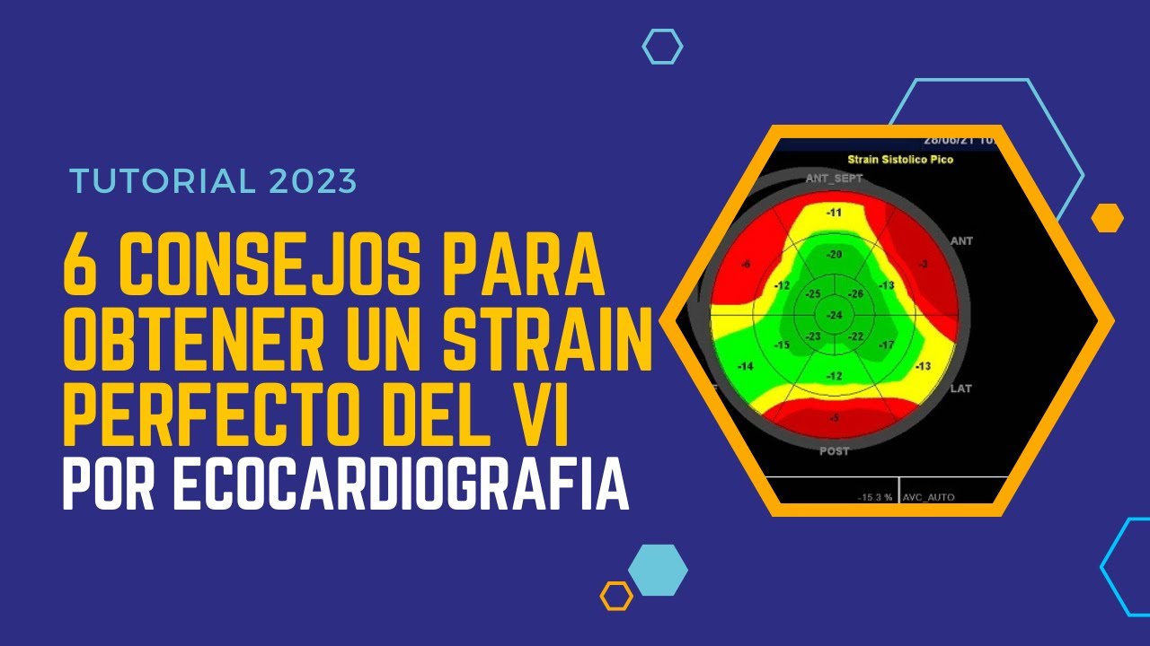 🚀Seis consejos para obtener un 💪STRAIN PERFECTO por ECOCARDIOGRAFÍA