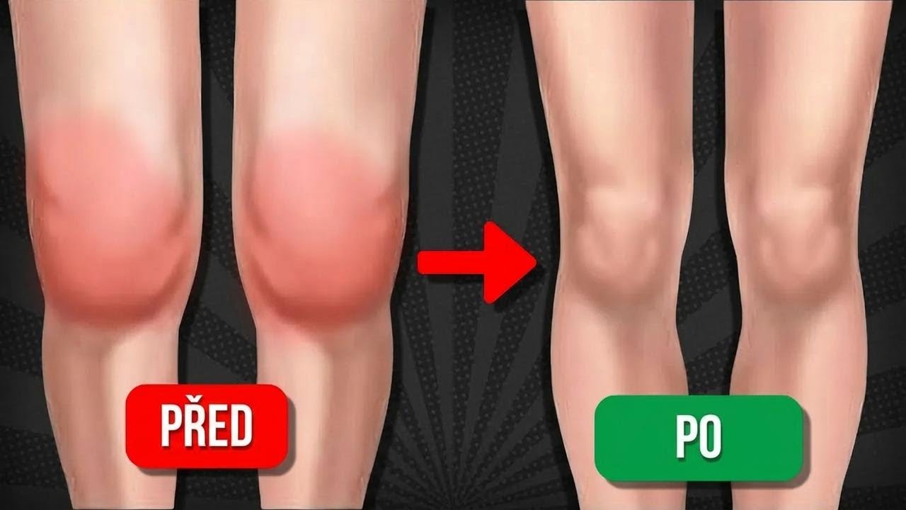 5 cviků na odvodnění a uvolnění bolavých kolen – vyzkoušejte je doma