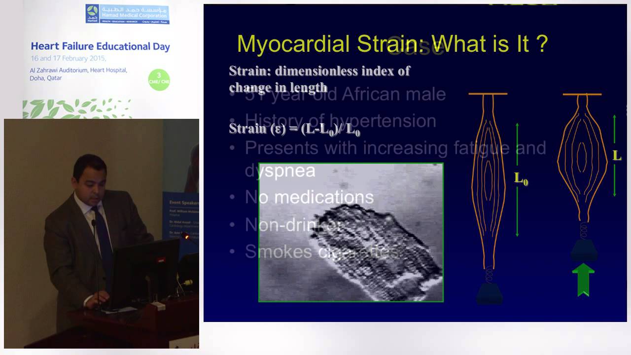 Hisham Dokainish - Echocardiography in diagnosis and prognosis of patients with heart failure