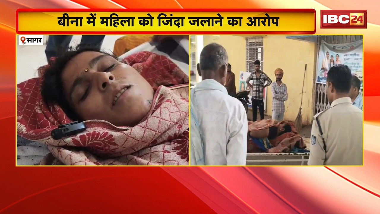 Sagar Crime News: बीना में महिला को जिंदा जलाने का आरोप। 3 साल पुराने जमीन विवाद में हत्या की कोशिश