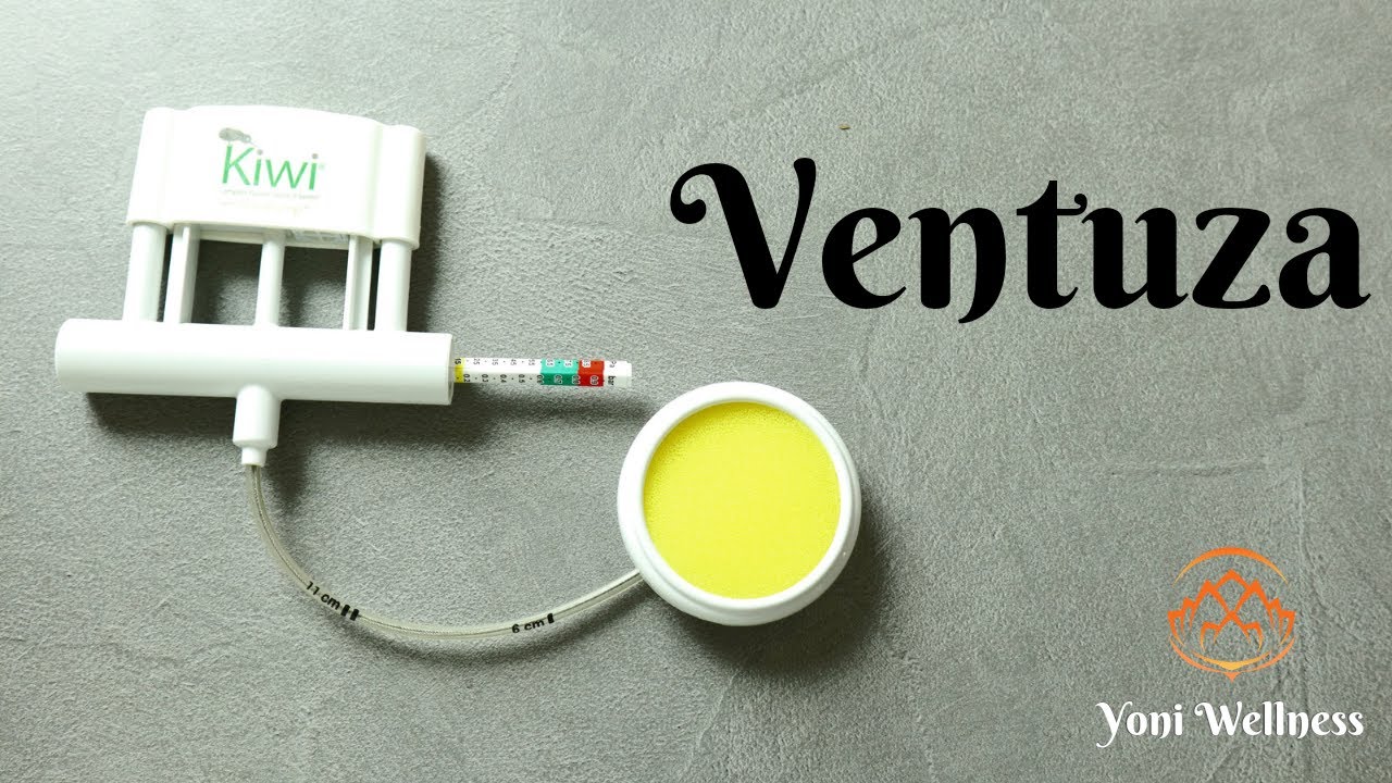 S1.Ep62: Naşterea cu VENTUZĂ (vid-extractor ) | Când mama nu mai poate împinge | Complicații