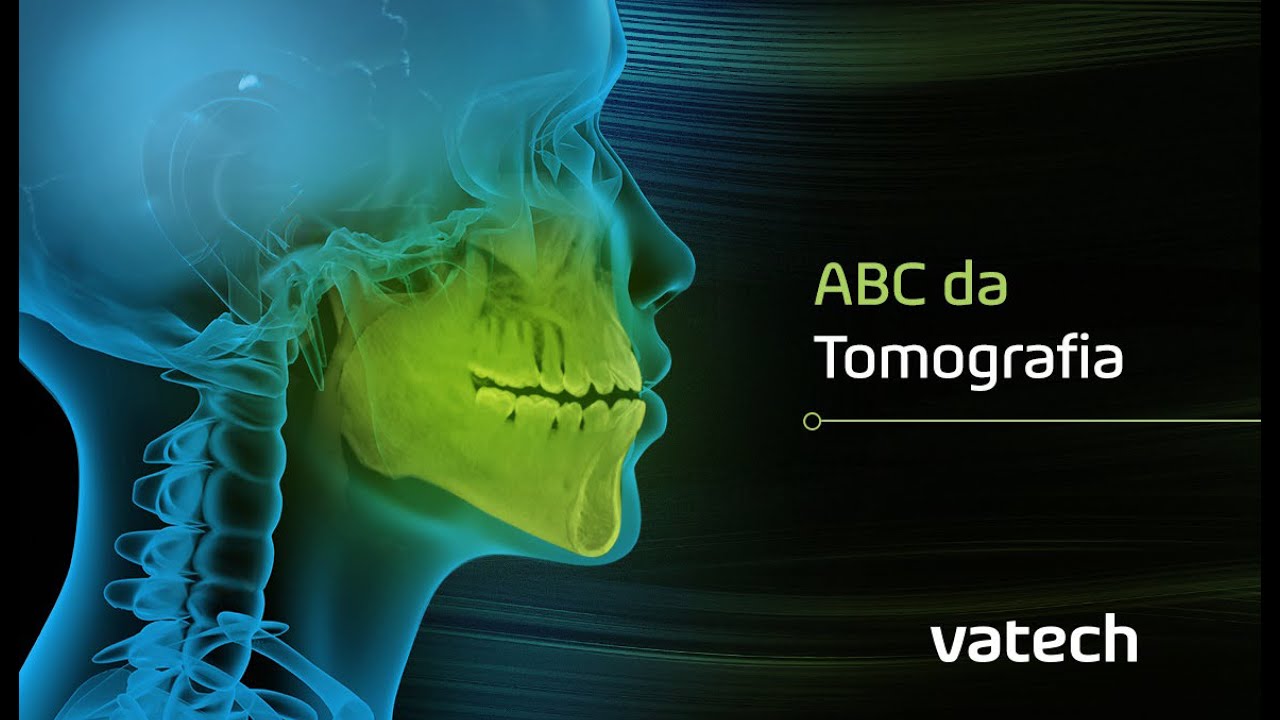 LIVE Vatech - ABC da Tomografia Odontológica - Noções básicas e principais dúvidas