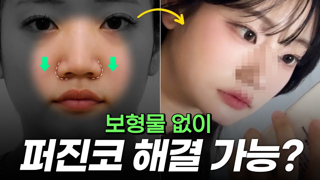 실리콘은 죽어도 안된다는 그녀😱,  보형물 없이 코성형 전과정 공개!!✨