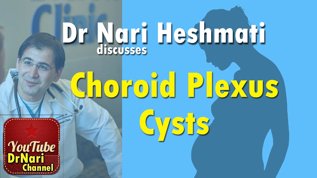 CPC: Choroid Plexus Cysts on Ultrasound in Pregnancy Discussed by Dr Nari Heshmati