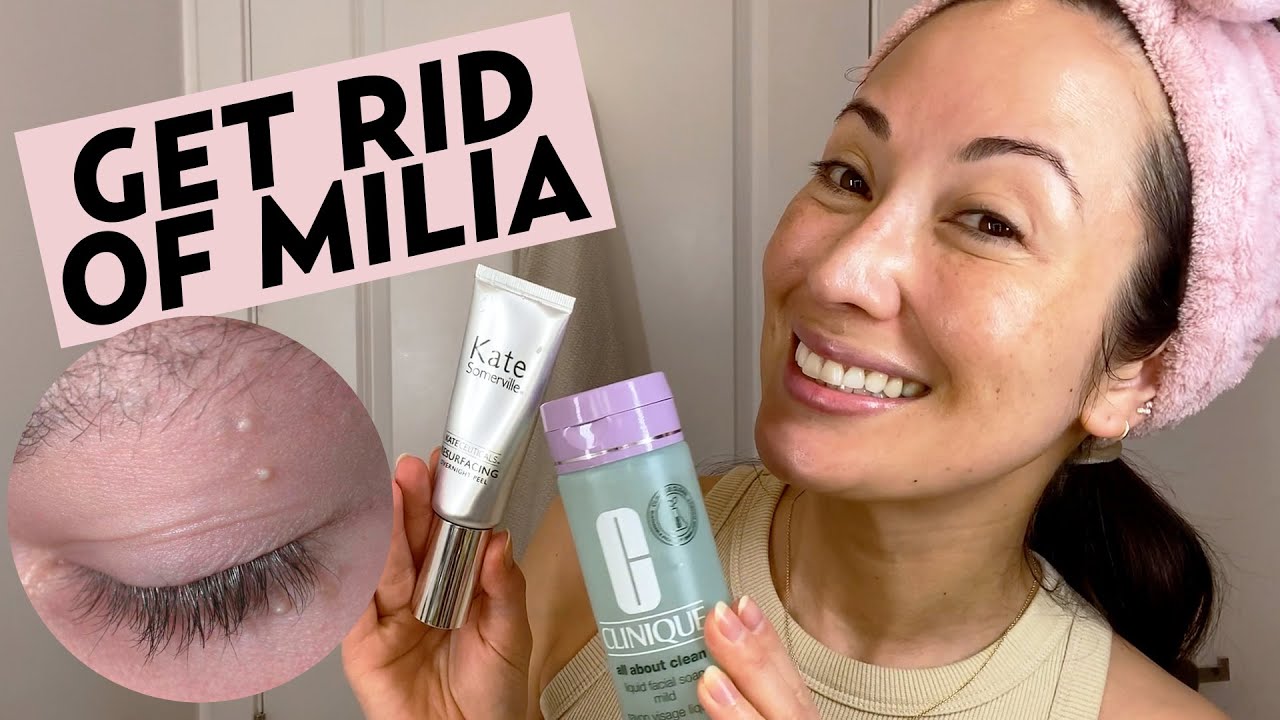 Get Rid of Milia With This Nighttime Skincare Routine (Removal & Treatment Tips) | Susan Yara