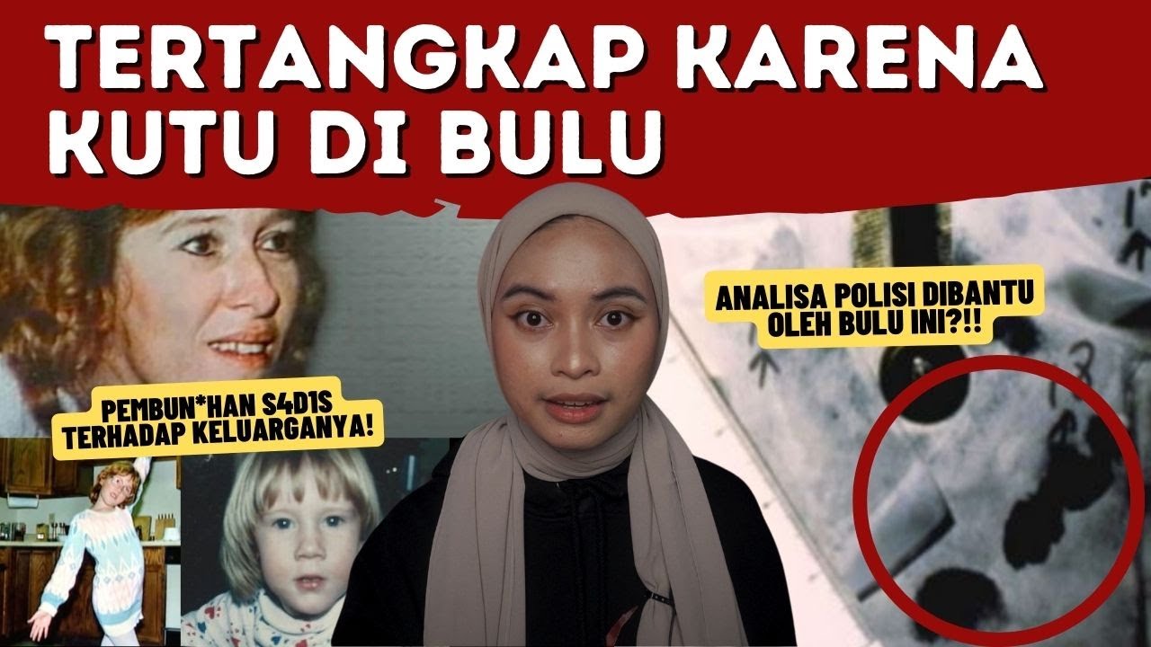 Tertangkap karena KUTU di Bulu?! - Kirby Anthoney