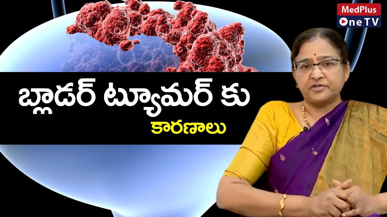 Baldder Tumor Causes and Treatment Explained By Dr.K.Lalitha || @MedPlusONETV