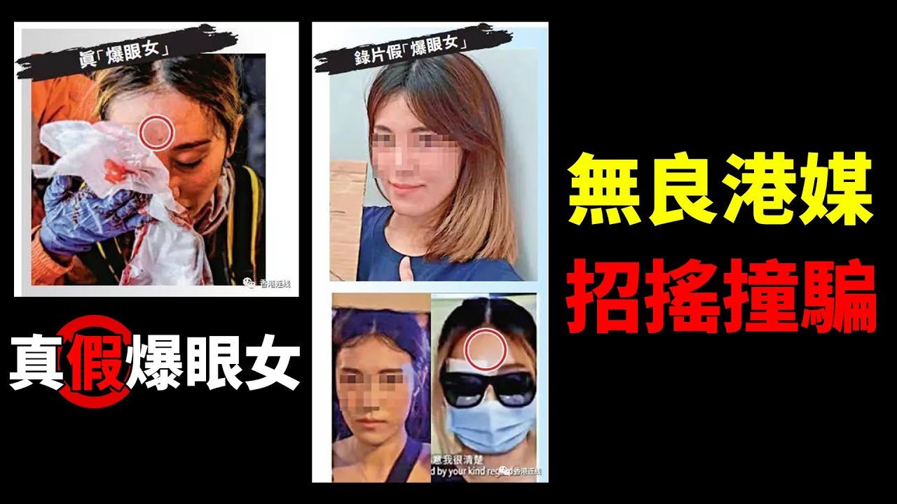 真假「爆眼女」身份曝光！