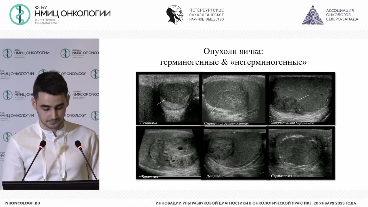 Роль мультипараметрического УЗИ в диагностике опухолей яичек