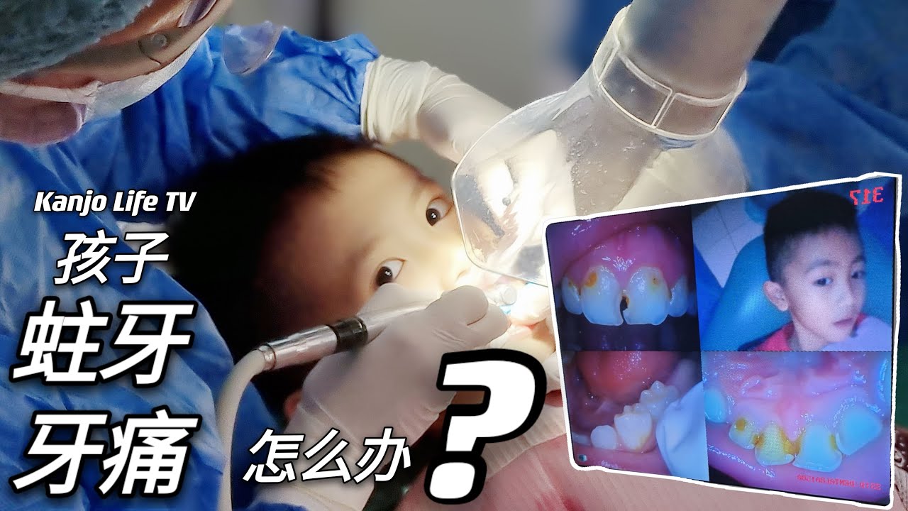 孩子牙痛怎么办｜孩子牙齿发黑｜教你立刻止疼｜日常生活Vlog｜日常生活教育｜生活教育｜孩子牙痛怎么止疼｜照顾牙疼的孩子需要注意的事项｜定期给孩子看牙医｜检查或清洁孩子的牙齿｜童年的回忆｜牙齿的健康程度
