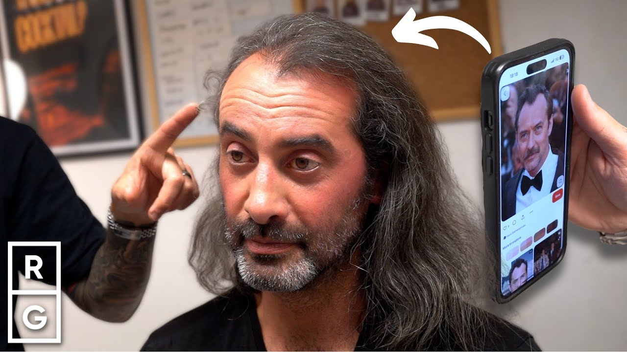 He Got a RECEDING Hairline Transformation Like the 