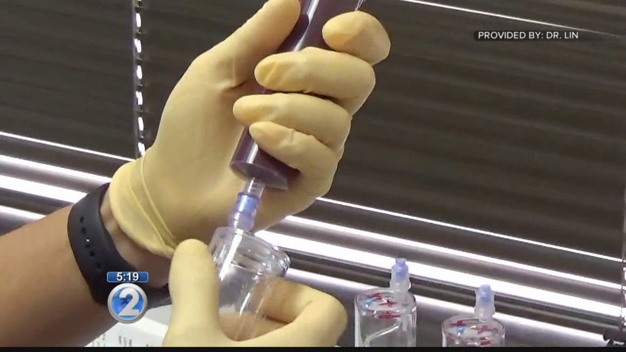 The benefits, drawbacks of pain-relieving PRP therapy