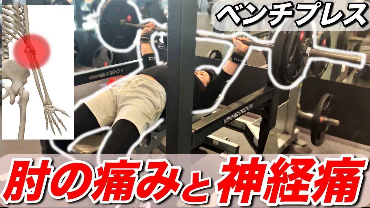 【ベンチプレス】肘の痛みが治らない原因と、神経痛の改善方法【アームカール】