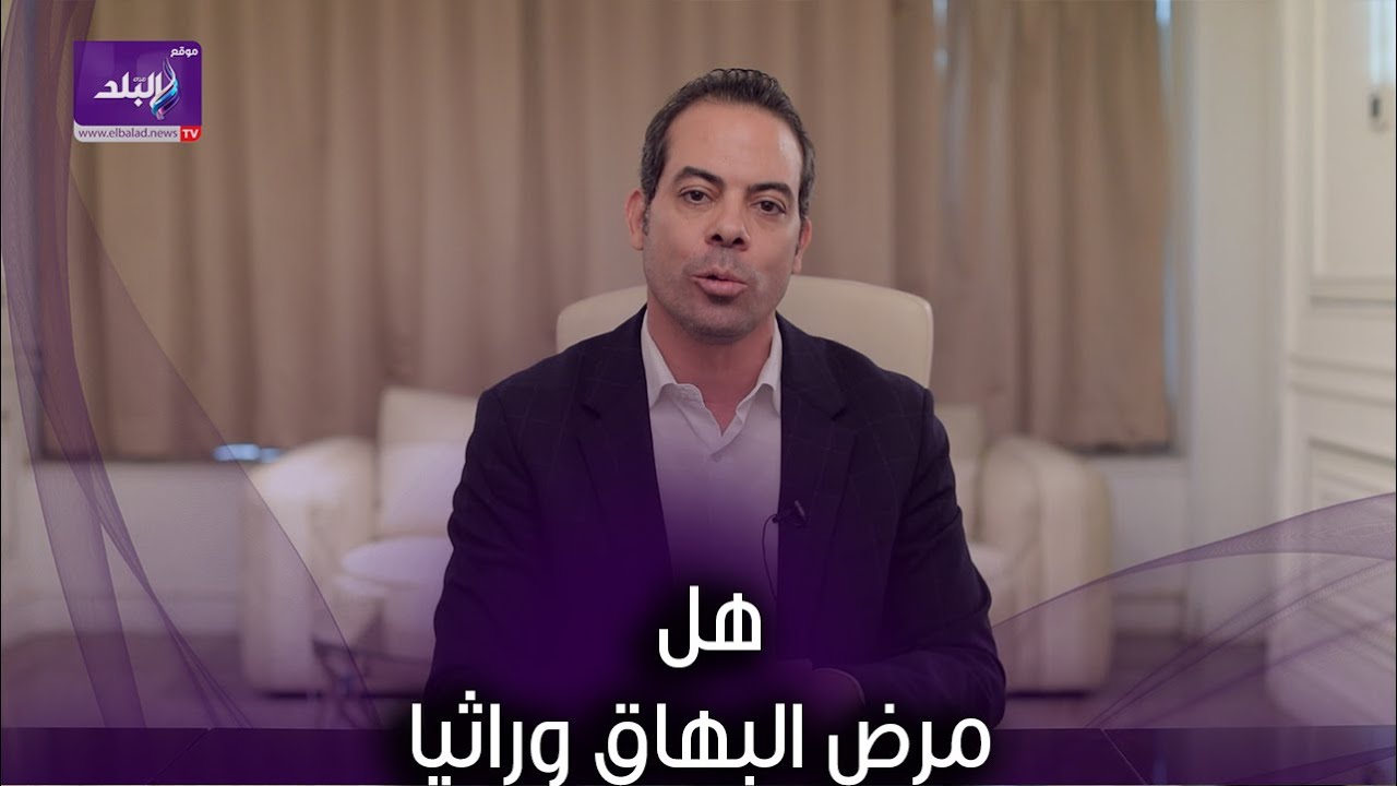 هل ينتقل مرض البهاق وراثيا ؟ .. وهذه العلاجات وهمية