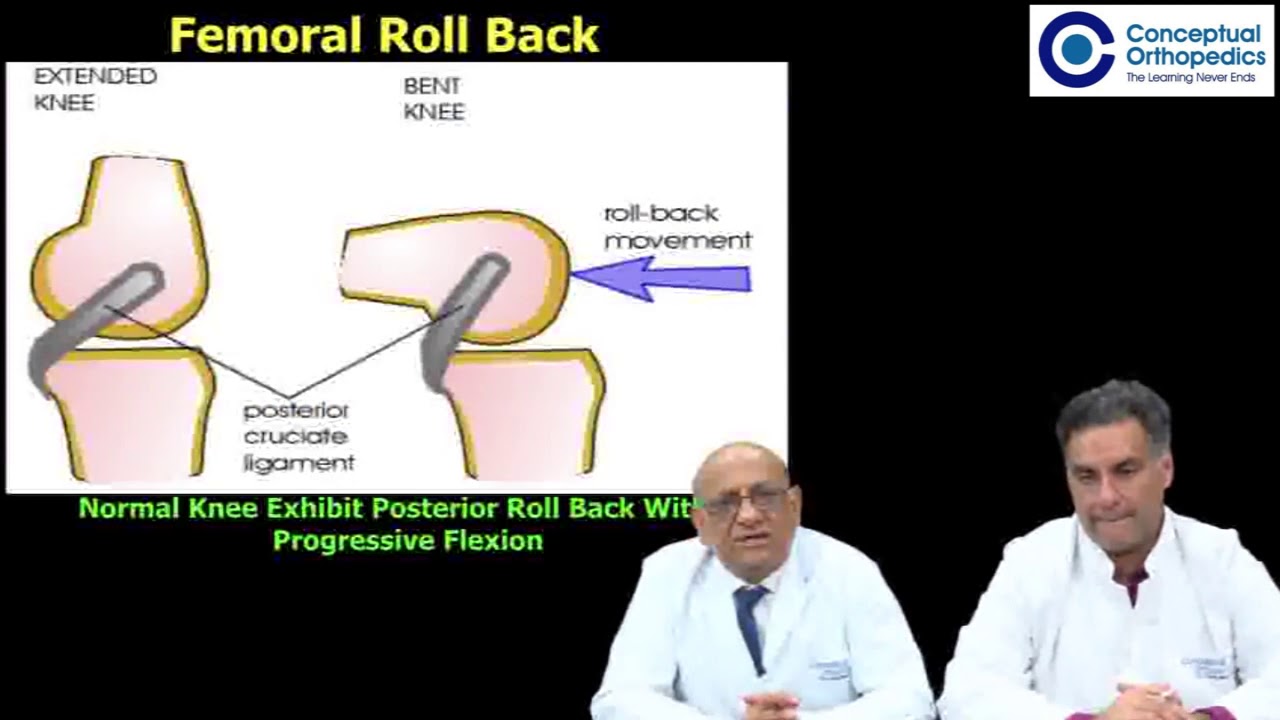 Pearls of Total Knee Replacement - Dr Shekhar Agarwal - The wise man of Orthopedics.