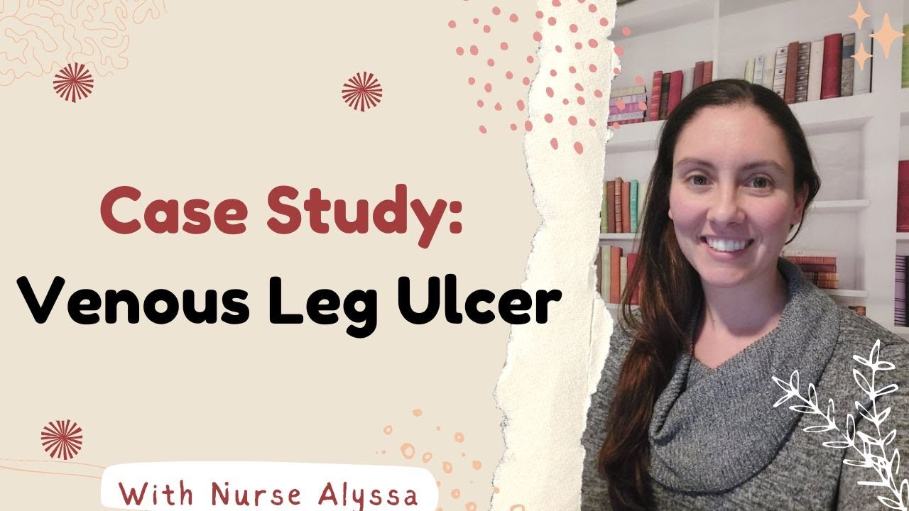 Venous Leg Ulcers: In-Depth Case Study & Treatment Strategies