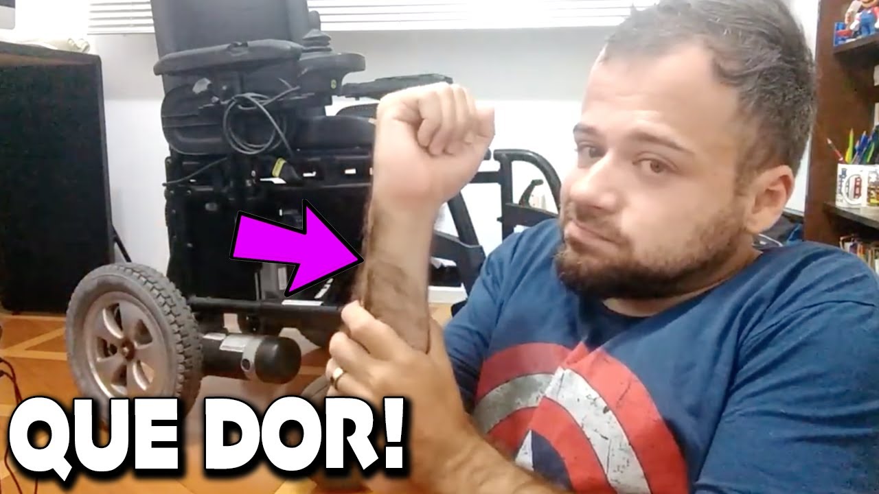 COMO É TER OSSOS DE VIDRO