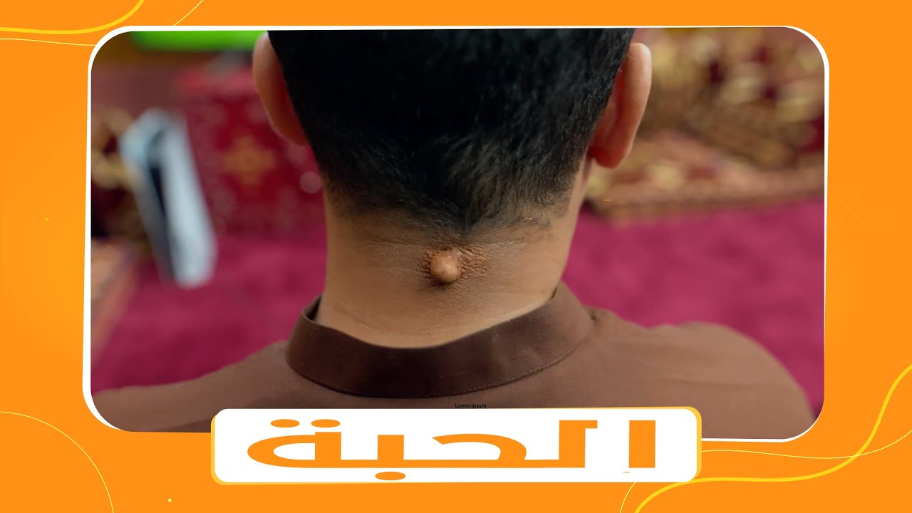 مسلسل شباب البومب الموسم 11 | الحلقة رقم 15 بعنوان 