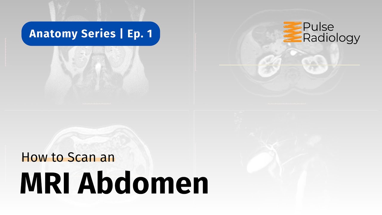 How to Scan an MRI Abdomen