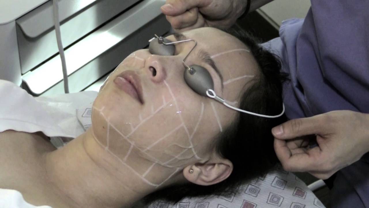Bride's Maid Needs Ultherapy Before Wedding!