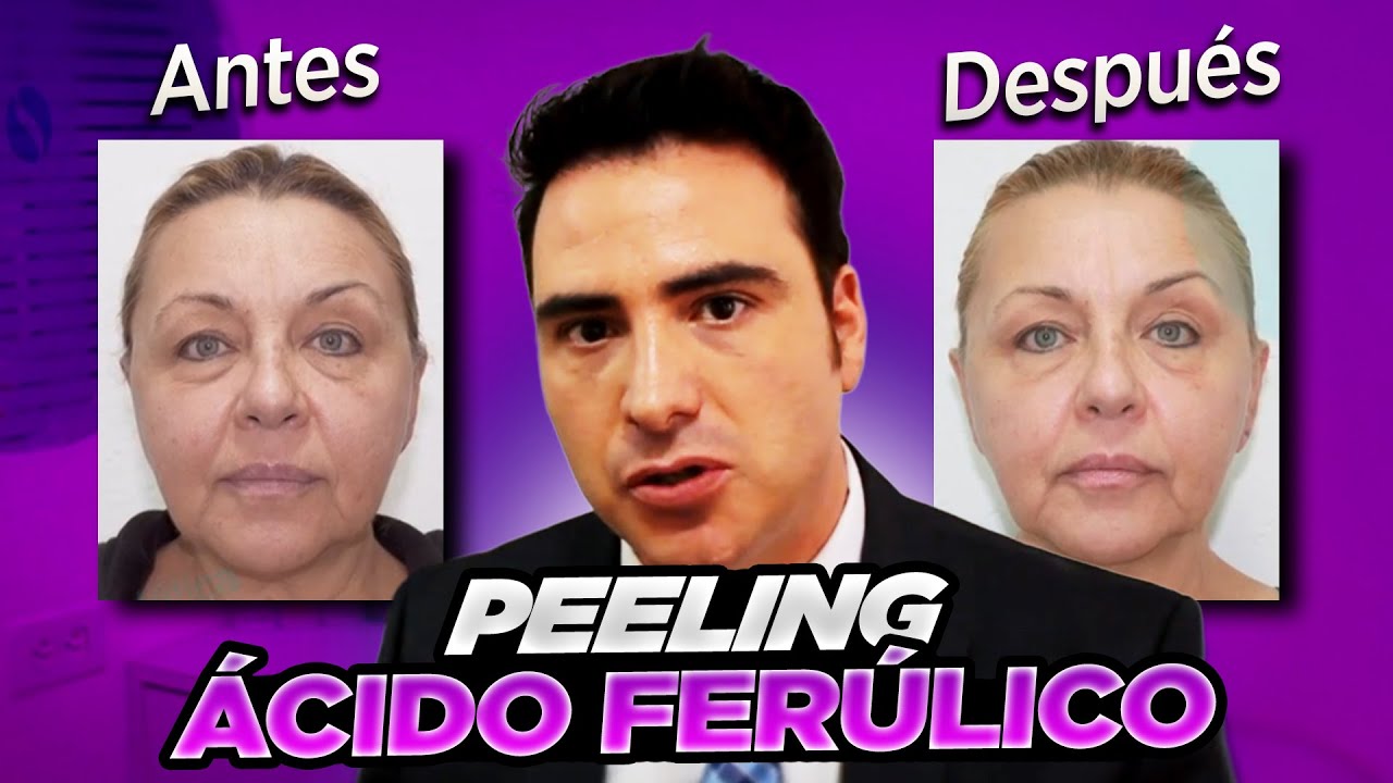 Peeling Revitalización Facial con Ácido Ferúlico