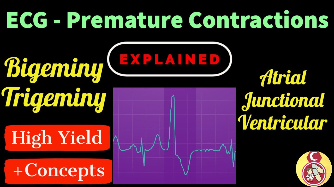 ECG Crash course - #7 Premature Contractions (Atrial and Junctional and ventricular)