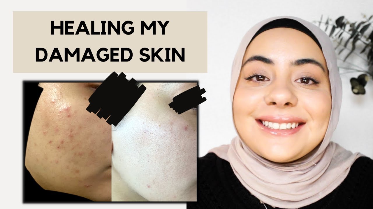 4 CHANGES I MADE TO HEAL MY SKIN BARRIER | How To Repair Skin Barrier Damage | Razia Moe