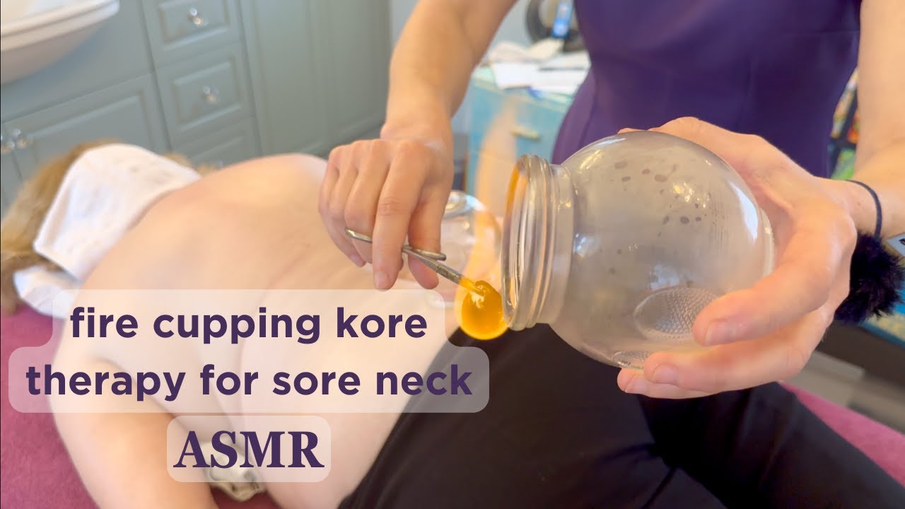 Fire Cupping Kore Therapy for Sore Neck and Shoulder 🔥