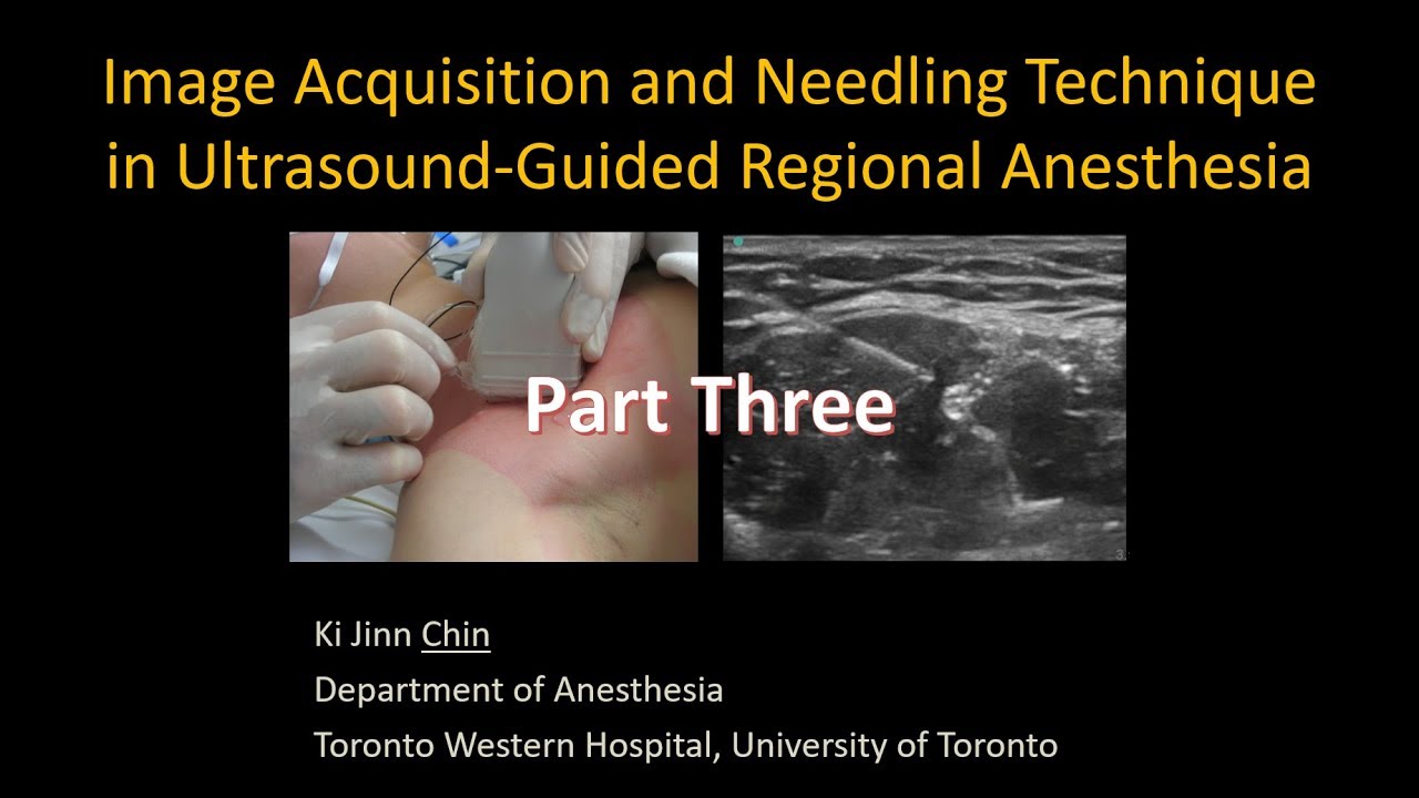 Image Acquisition and Needling in Ultrasound-Guided Interventional Procedures - Part 3