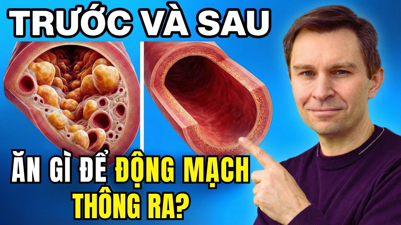 Giáo sư Di truyền học: #1 Bữa Ăn Giúp Thông Thoáng Động Mạch Của Bạn (Được Khoa Học Chứng Minh)