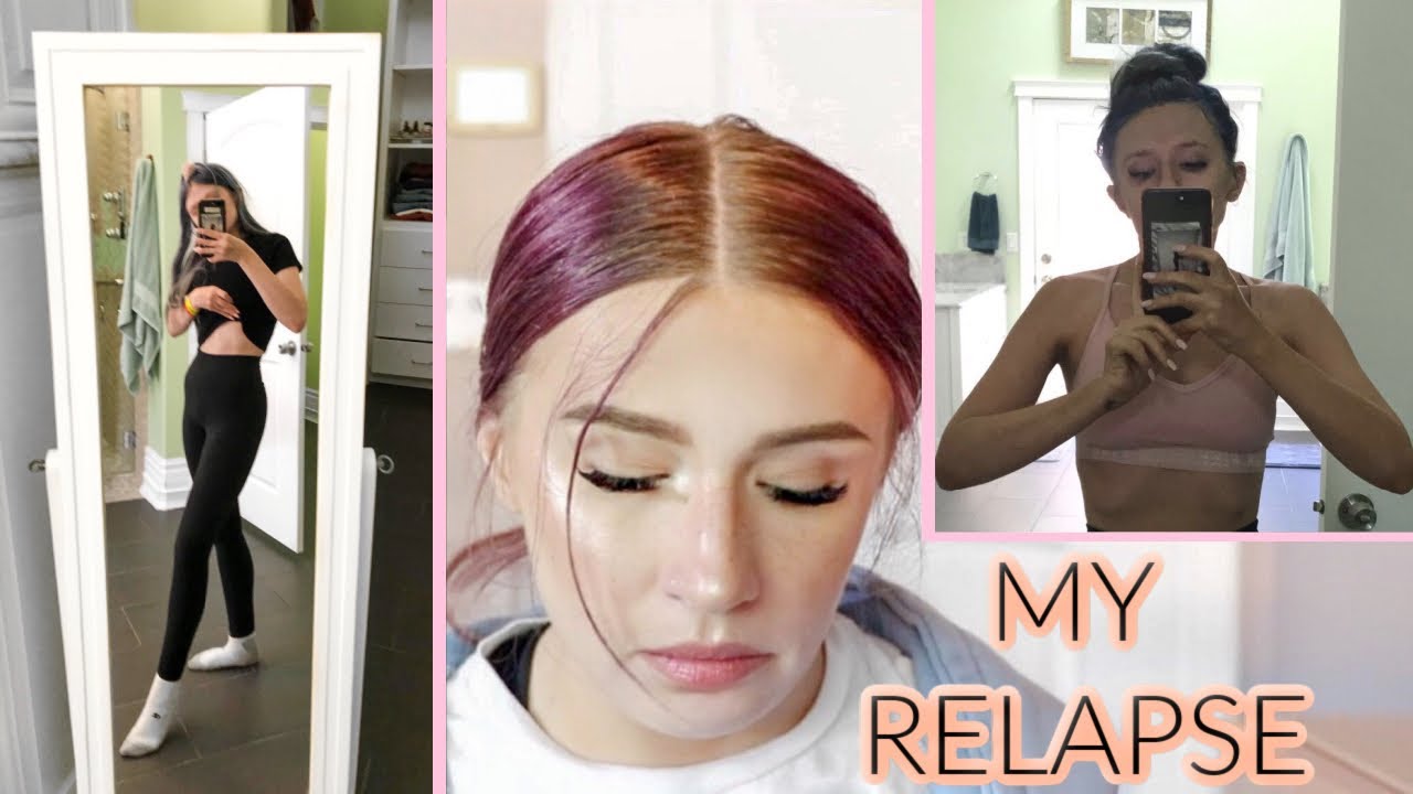 My Eating Disorder Story Part 2 | Relapse