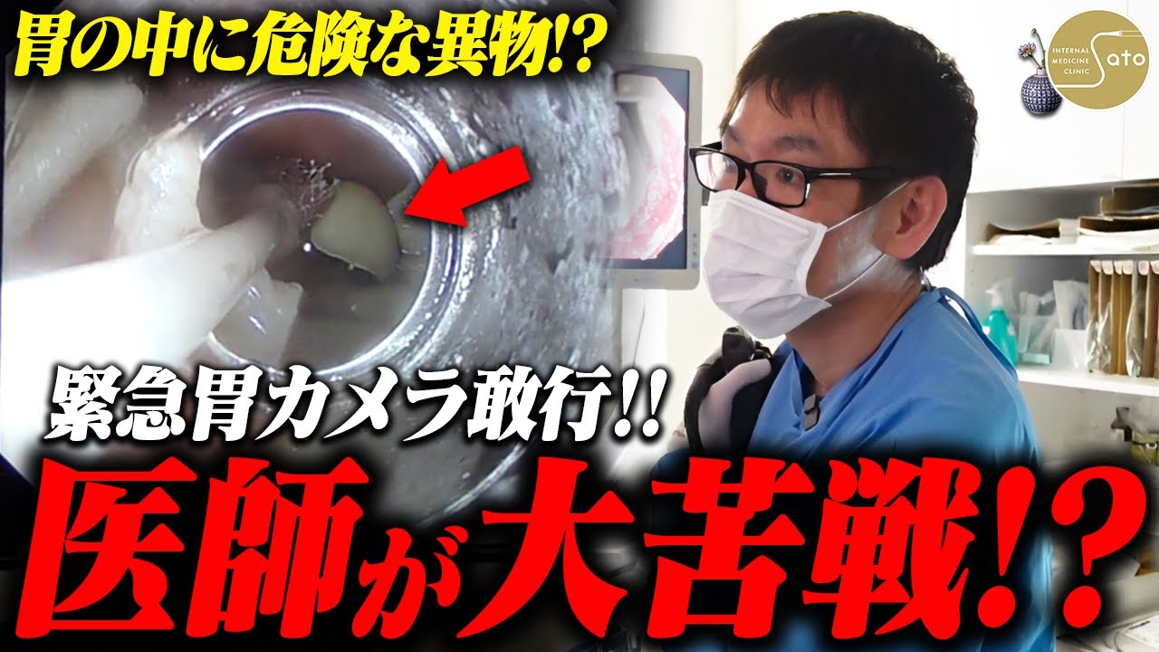 『歯を飲み込んだ！？』緊急胃カメラ検査敢行！！内視鏡医も大苦戦！？
