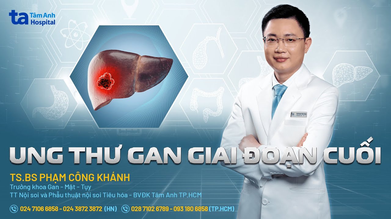 Ung thư gan giai đoạn cuối: Triệu chứng, chẩn đoán, phòng ngừa | TS.BS Phạm Công Khánh | THTA
