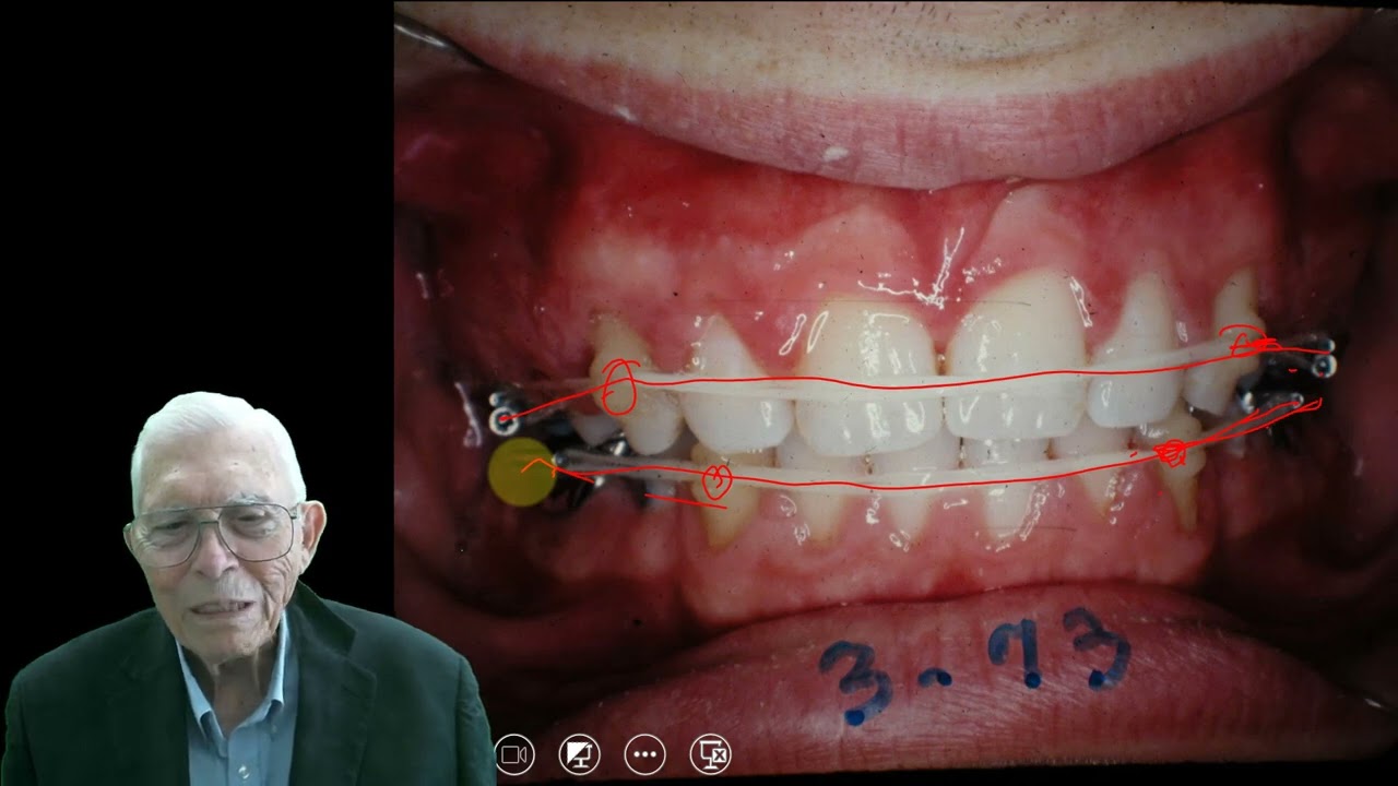 What Can Be Done With The Human Face: Orthodontics