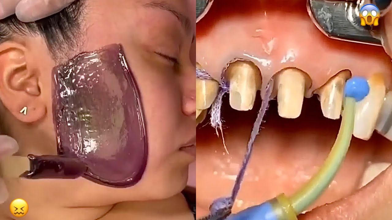 Most Extreme Beauty Treatments 2022 Best Smart and Helpful Beauty Hacks | Virtual Beauty