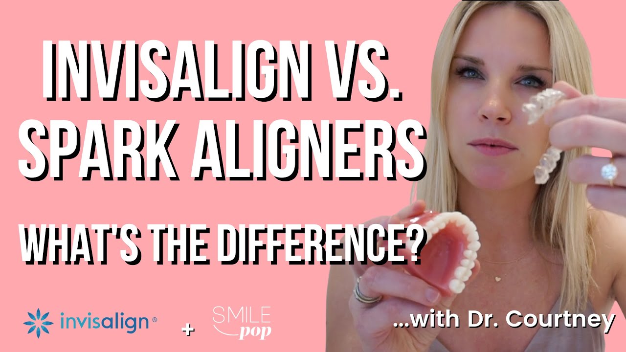 INVISALIGN AND SPARK CLEAR ALIGNERS 2024 | Which brand is better?