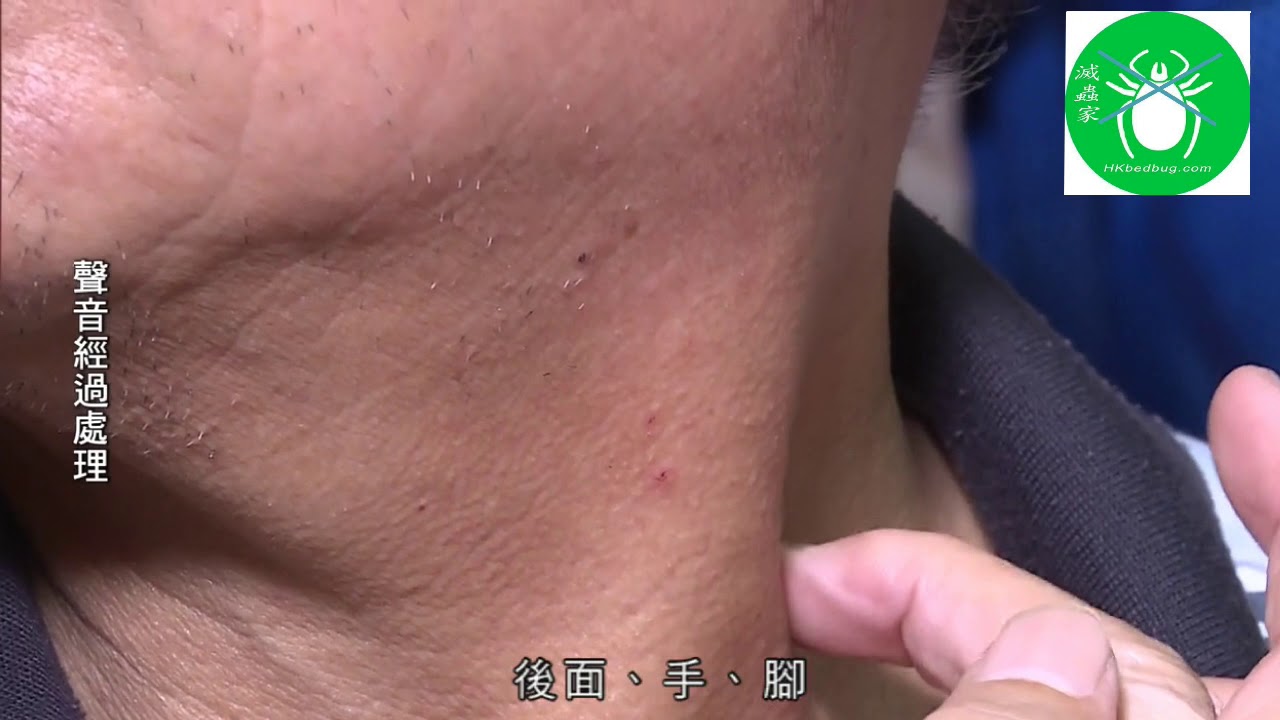床蝨
