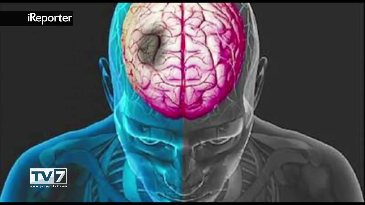 Tv7Triveneta - Ictus: focus su prevenzione e riabilitazione