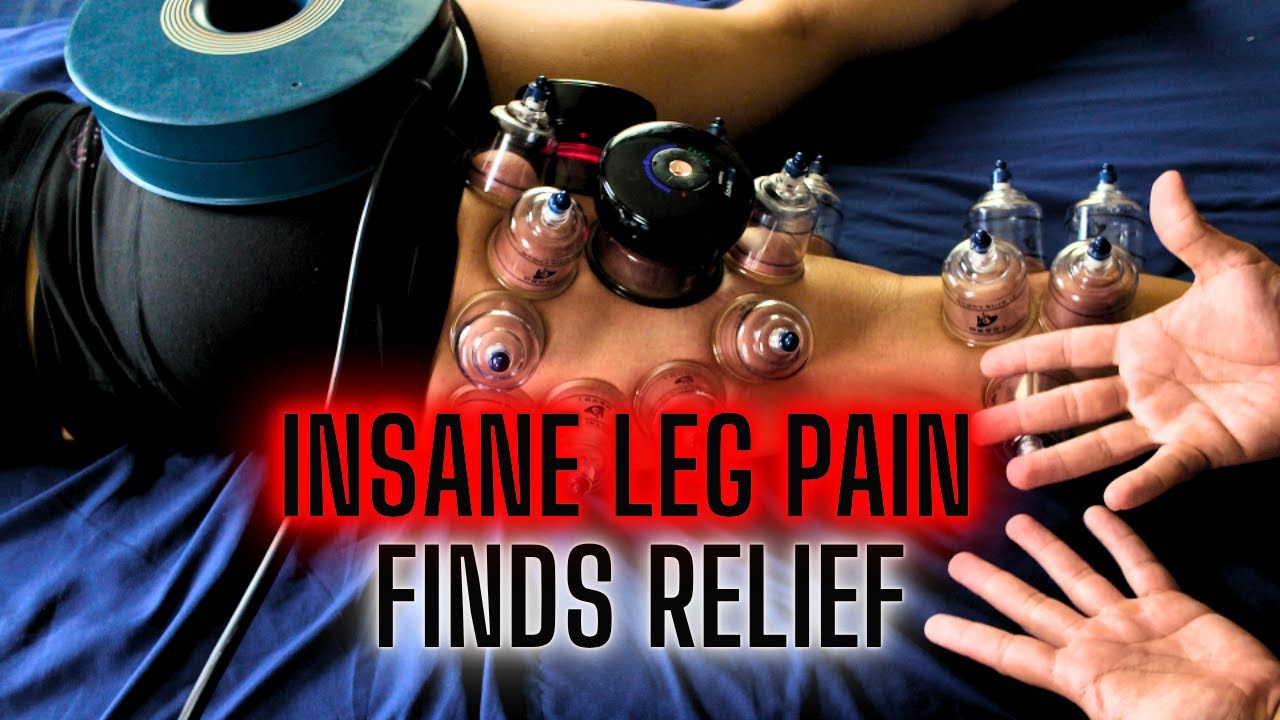 Pulled  Quad & Hamstring INSANE ASMR | Deep Tissue, Cupping & PEMF for RDL Recovery
