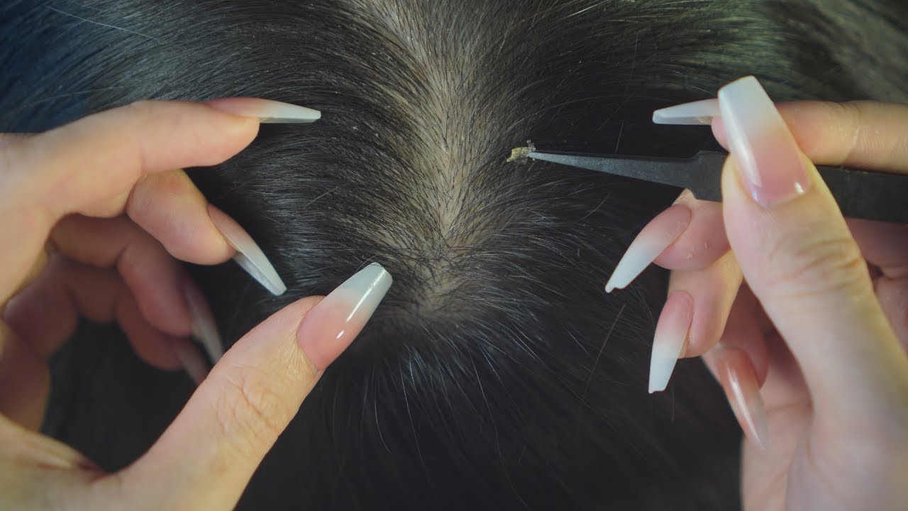 ASMR Gentle Scalp Check And Long Nails Scalp Scratching | Full Hair Sounds For Sleep ( No Whisper )