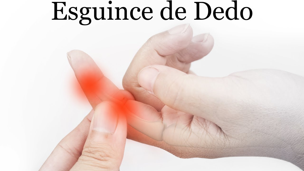 Inflamaci&oacute;n Dolor de Dedo Esguince Rutina de Maniobras