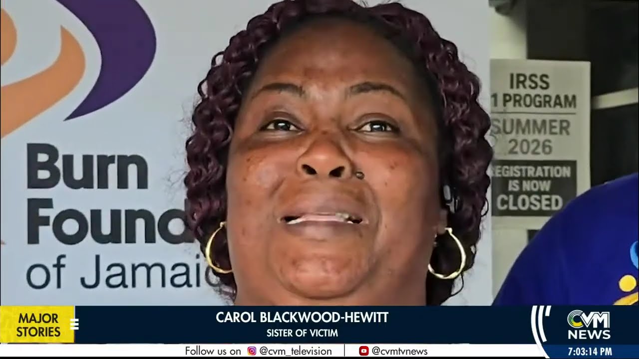 Westmoreland Burn Victim's Family Pleads For Urgent Help | Feb. 22, 2025  | @CVMTVNews