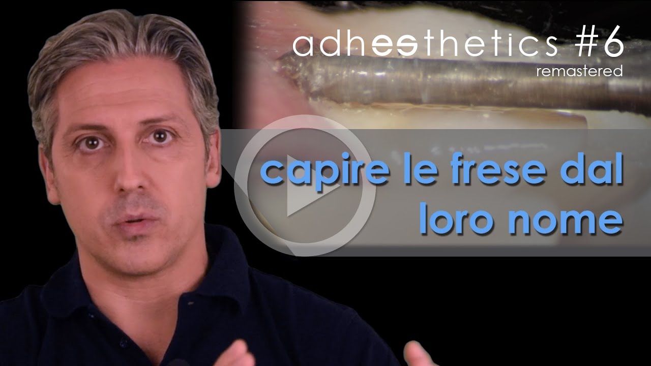 🇮🇹 Capire le frese dal loro nome_corto#6 ITA_Adhesthetics Protocols