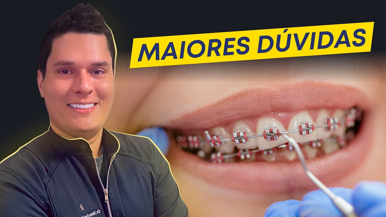 As 10 MAIORES DÚVIDAS sobre APARELHO ORTODÔNTICO que todo mundo tem!